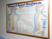 Effects of Spinal Misalignments